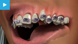 Orthodontics